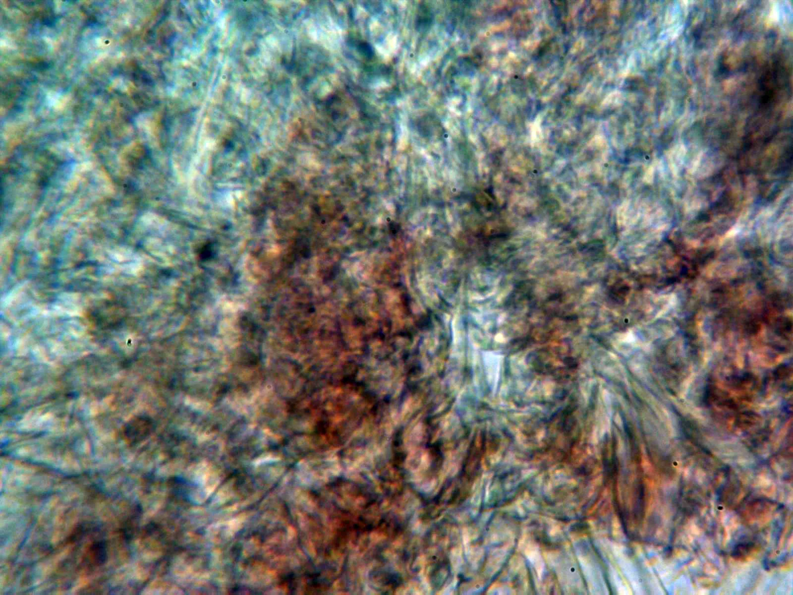 Microscopía de Phallus impudicus - 11 - Hifas peridio externo